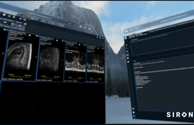 Spatial Radiology with Vision Pro: Native Vision Pro POCs for Radiology AI where images/windows follow your eyes 